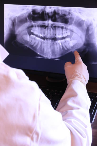 Best Emergency Tooth Extraction in Bernice, LA